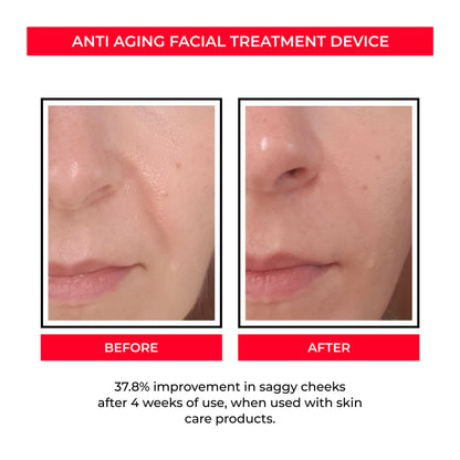 Beau EMS Eye Lifting
